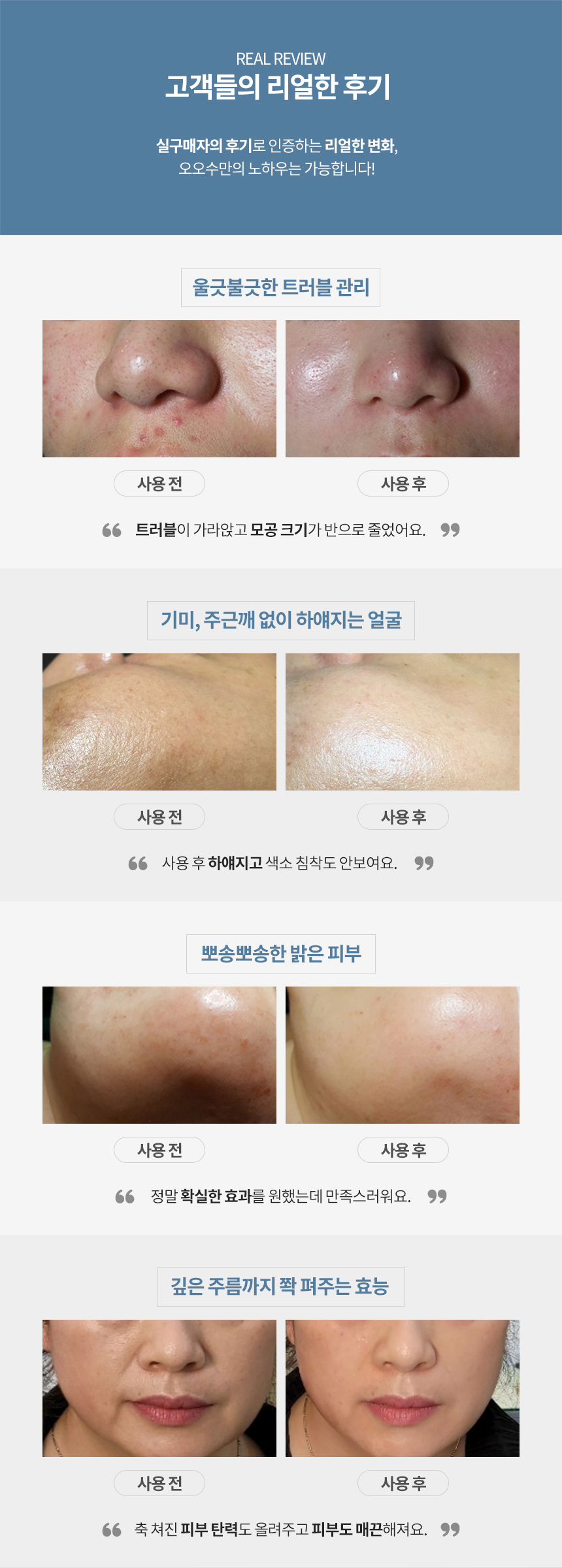 미백_상세페이지 (1).jpg